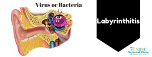 Labyrinthitis