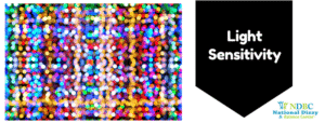light sensitivity