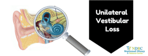 Unilateral Vestibular Loss